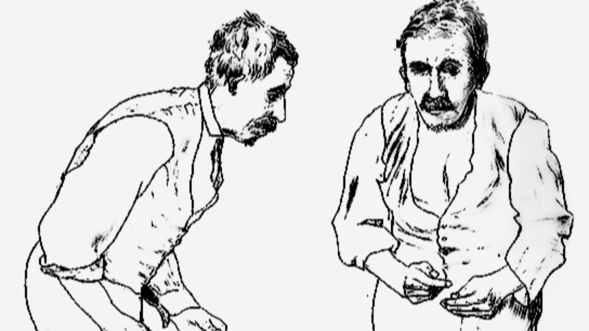 File:Person with Parkinson disease BW.jpg