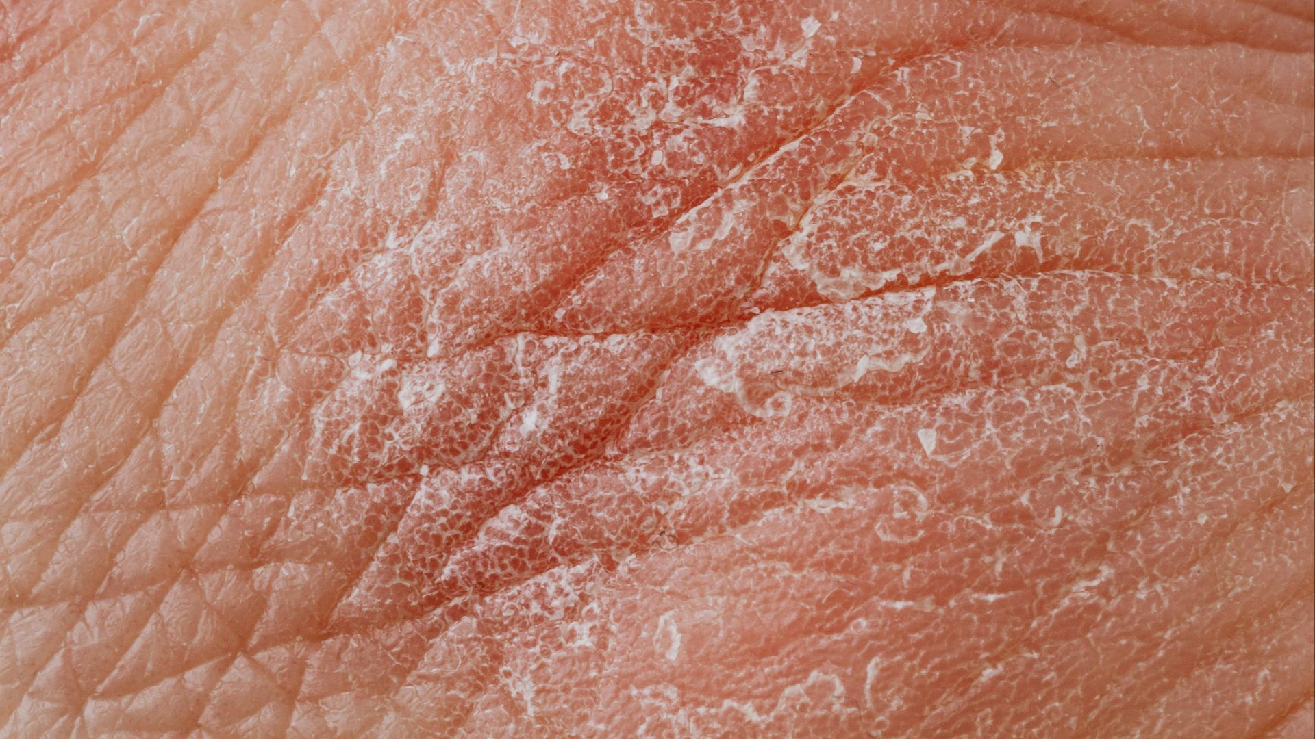 Photo By: Kaboompics.com