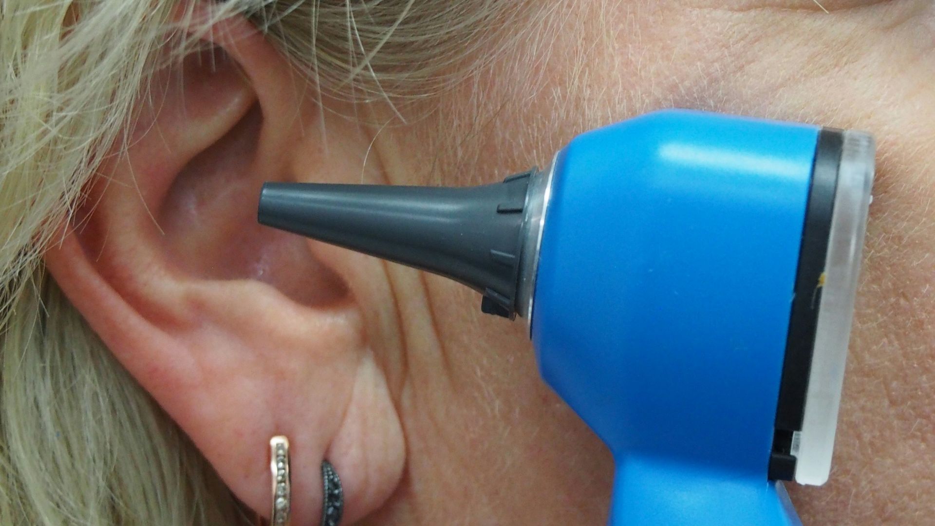 A doctor is using an otoscope to check ear.