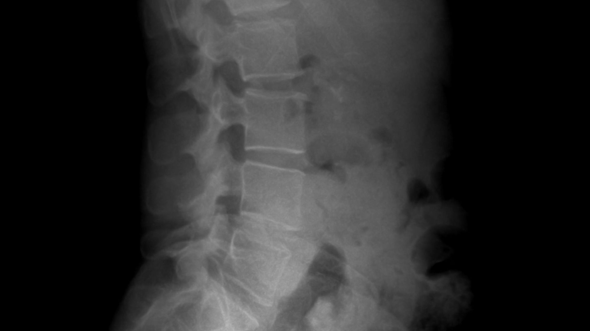 A black and white photo of a man's back