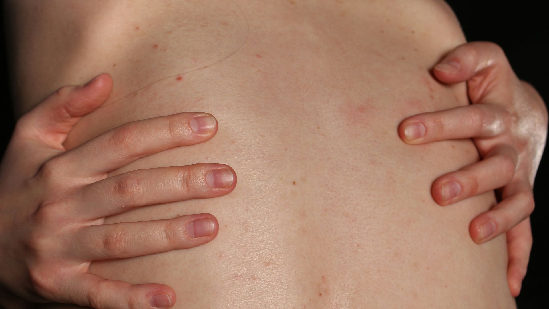 A person embraces their back with both hands.