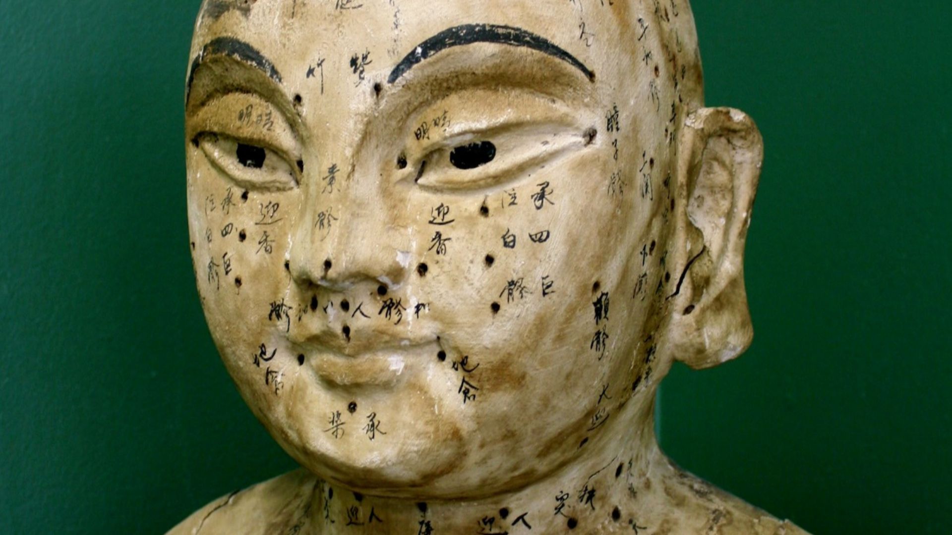 File:An ancient acupuncture statue.jpg