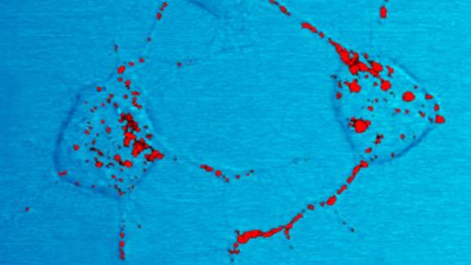 File:Prion trafficking- scrapie mouse (5661846150).jpg