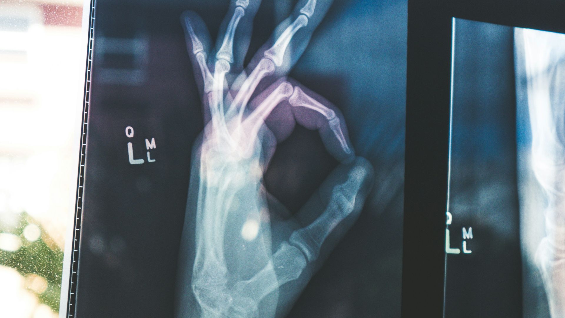 citiscan result hand ok