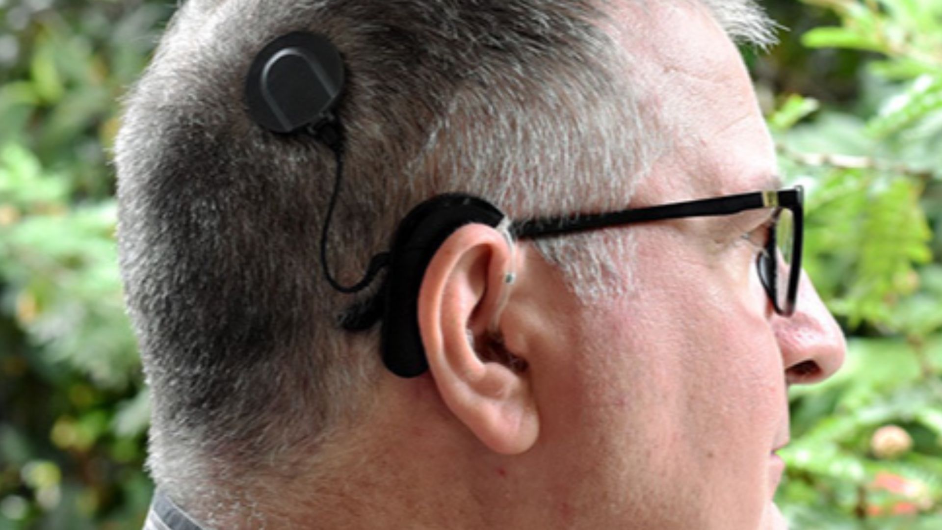 File:Cochlear implant user.jpg
