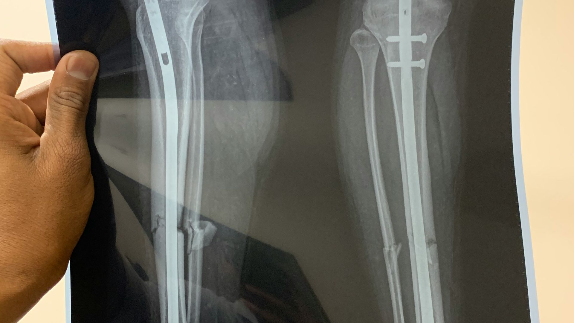 person holding white and black box