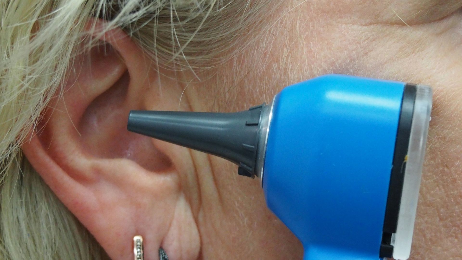 A doctor is using an otoscope to check ear.