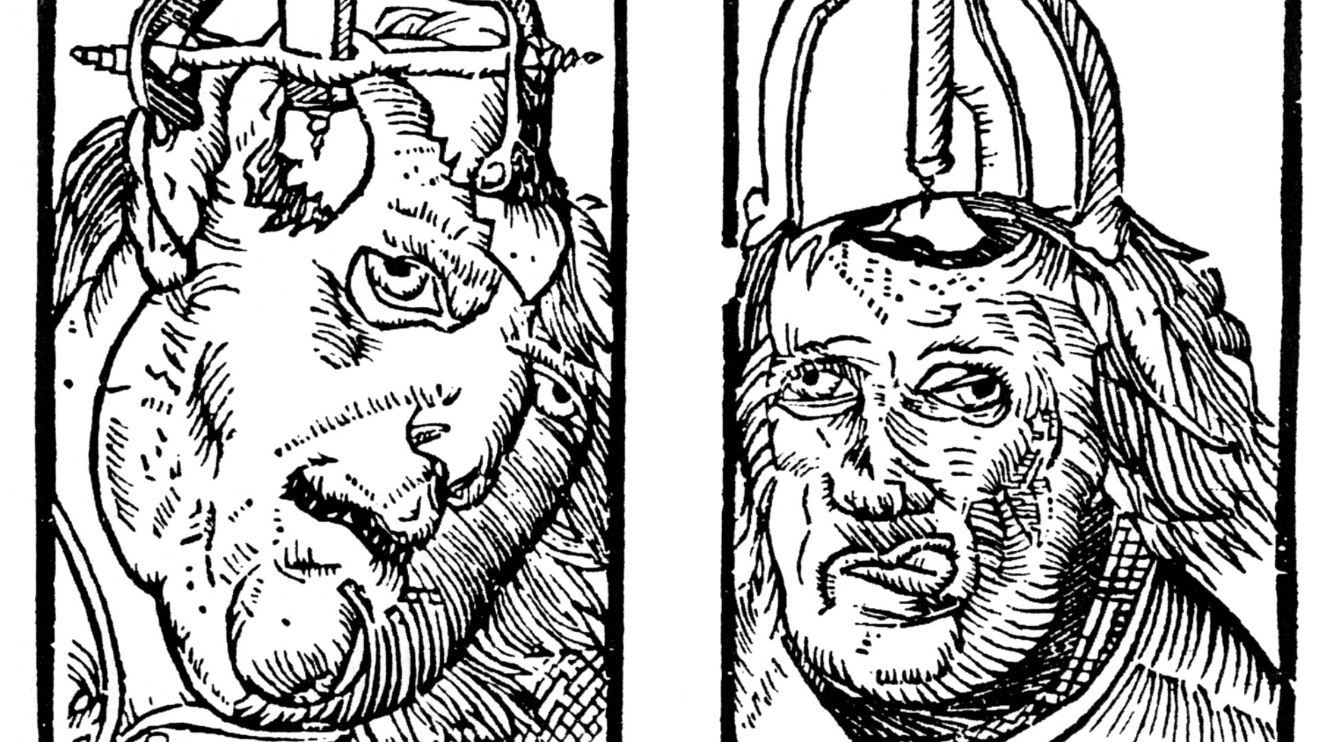File:Peter Treveris - engraving of Trepanation for Handywarke of surgeri 1525.png