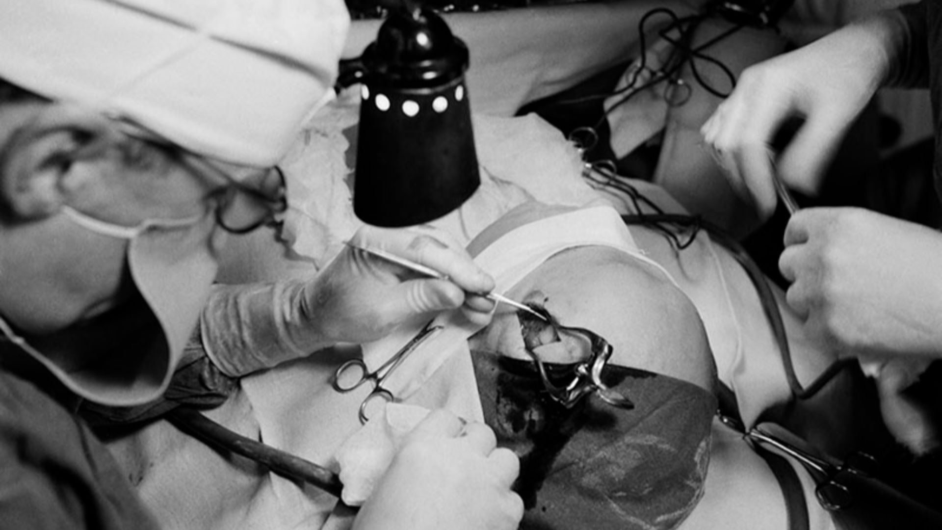 File:Lobotomy 1949.jpg