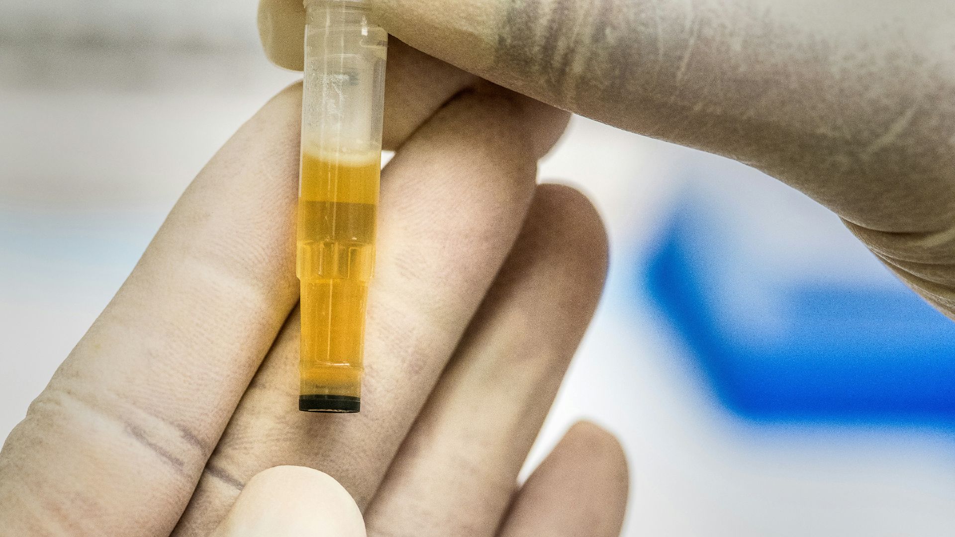 person holding yellow and clear tube