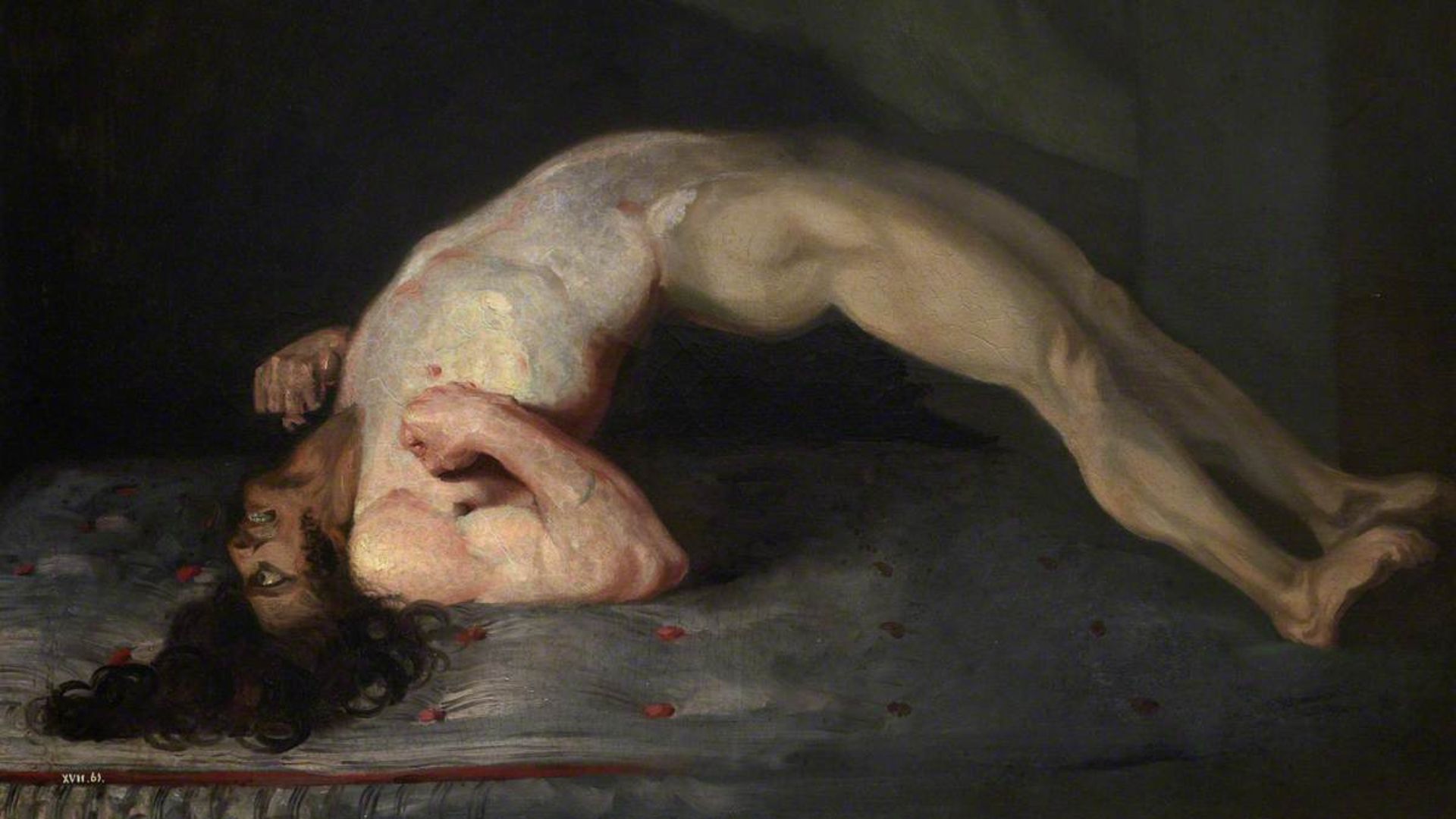 File:Opisthotonus in a patient suffering from tetanus - Painting by Sir Charles Bell - 1809.jpg
