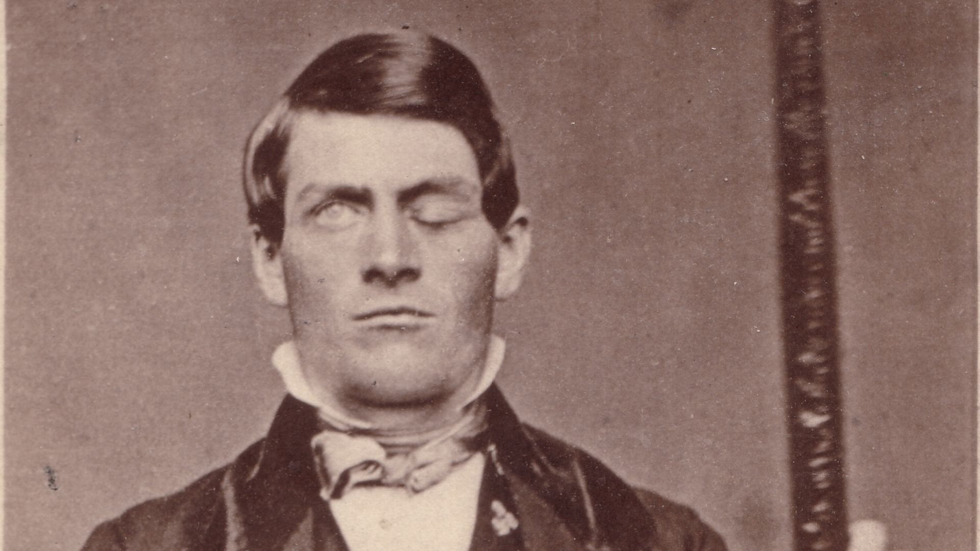 File:Phineas Gage GageMillerPhoto2010-02-17 Unretouched Color Cropped.jpg