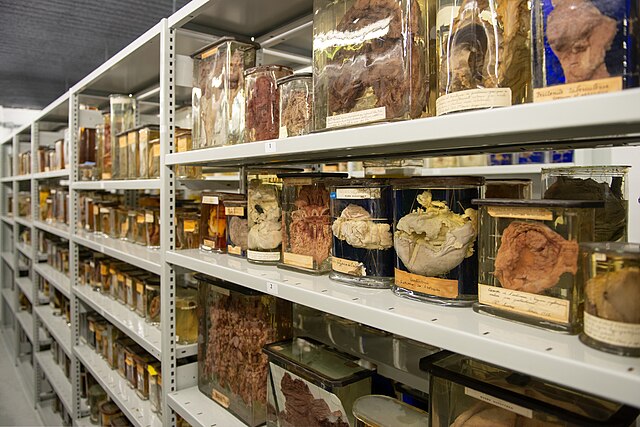 Réserve Des Préparations Humides Du Musée Dupuytren 1