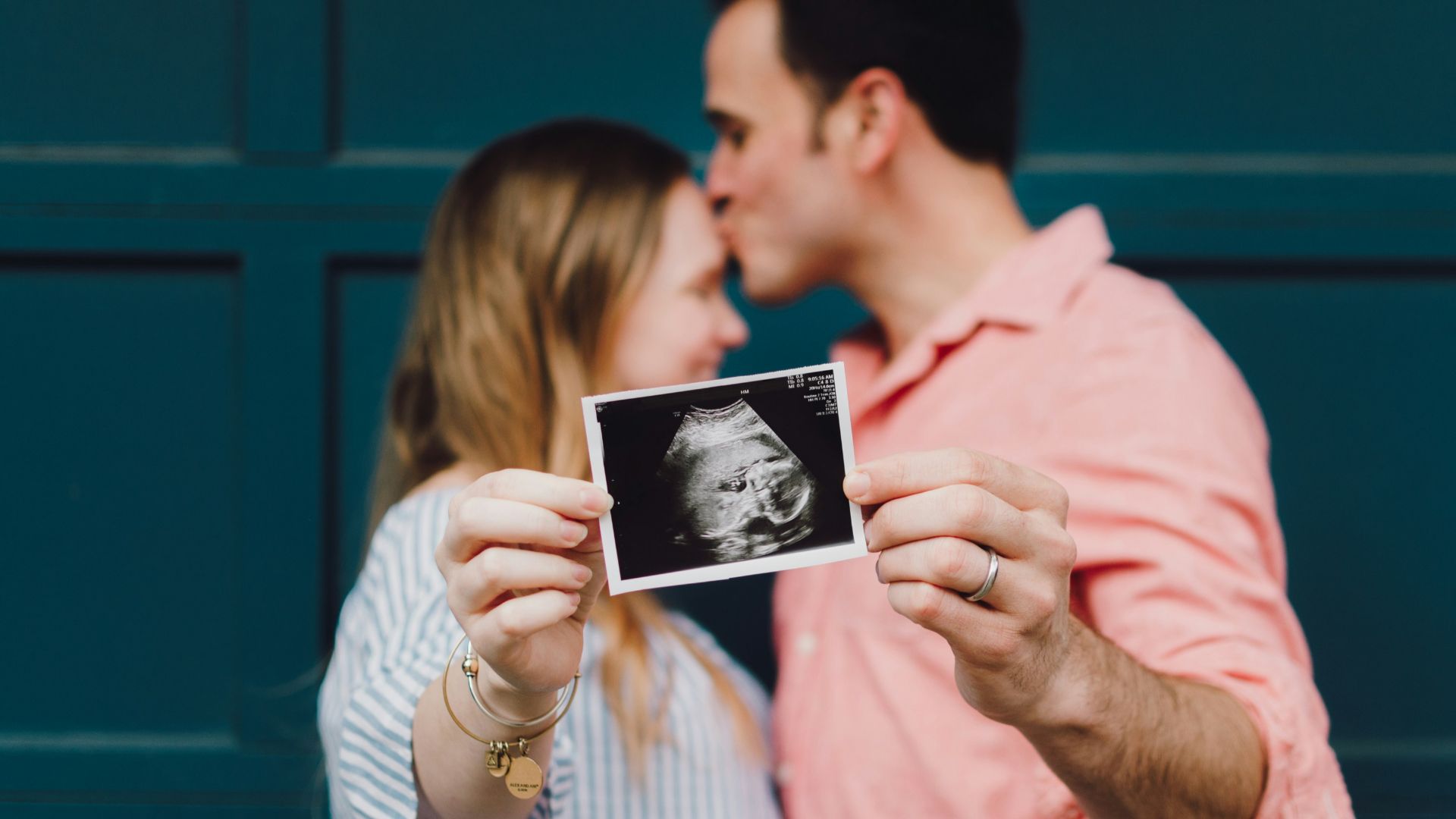 man kissing woman's forehead white holding ultrasound photo