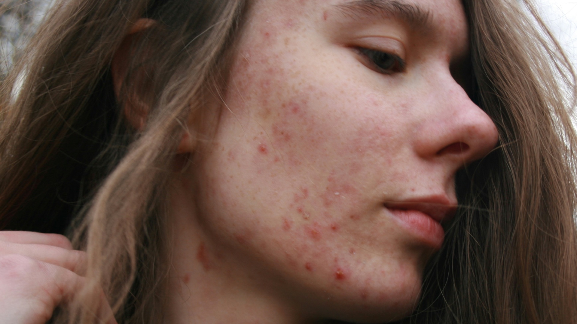 a woman with a substance on her face