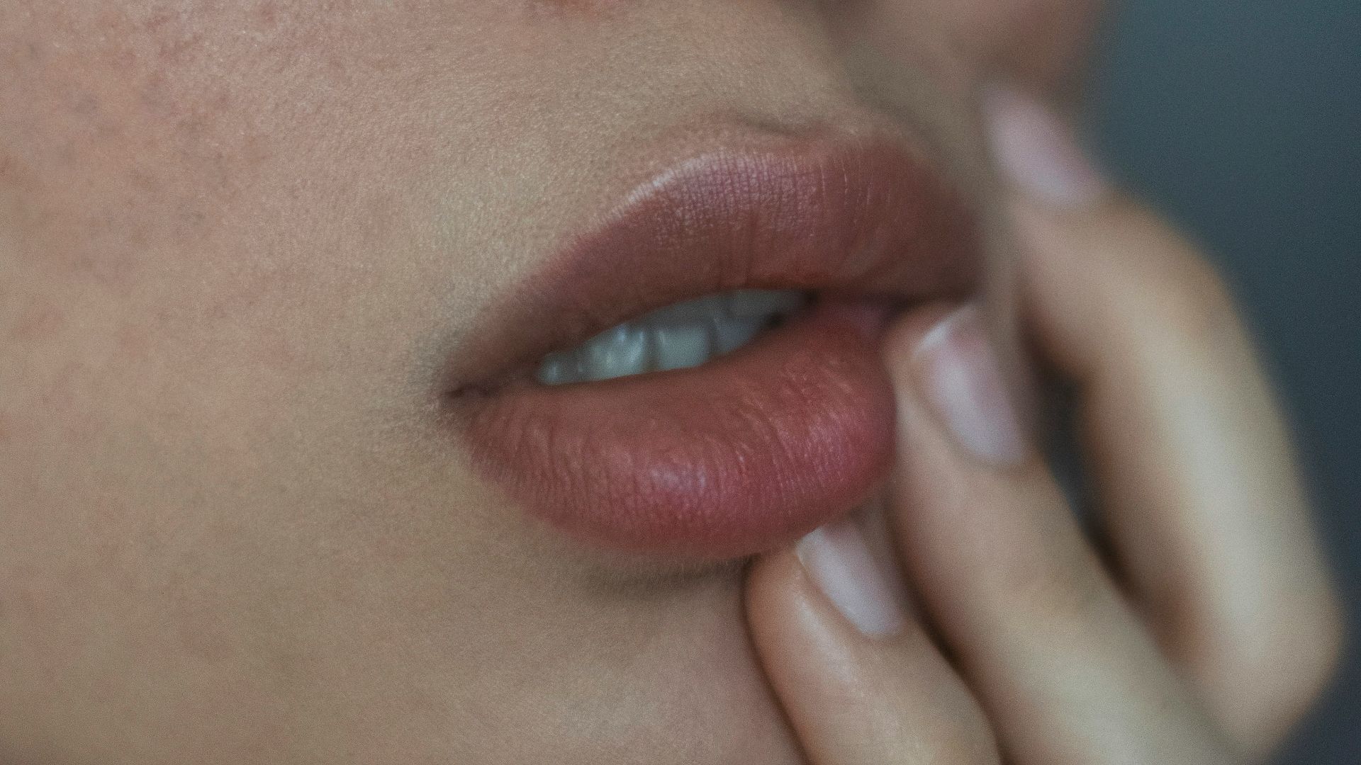 A woman with freckles and her hand on her lips.