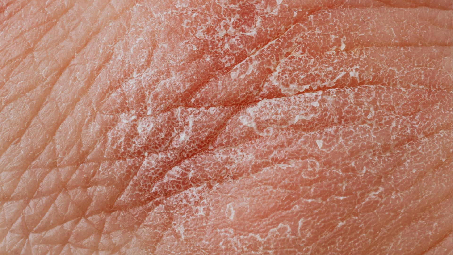 Photo By: Kaboompics.com