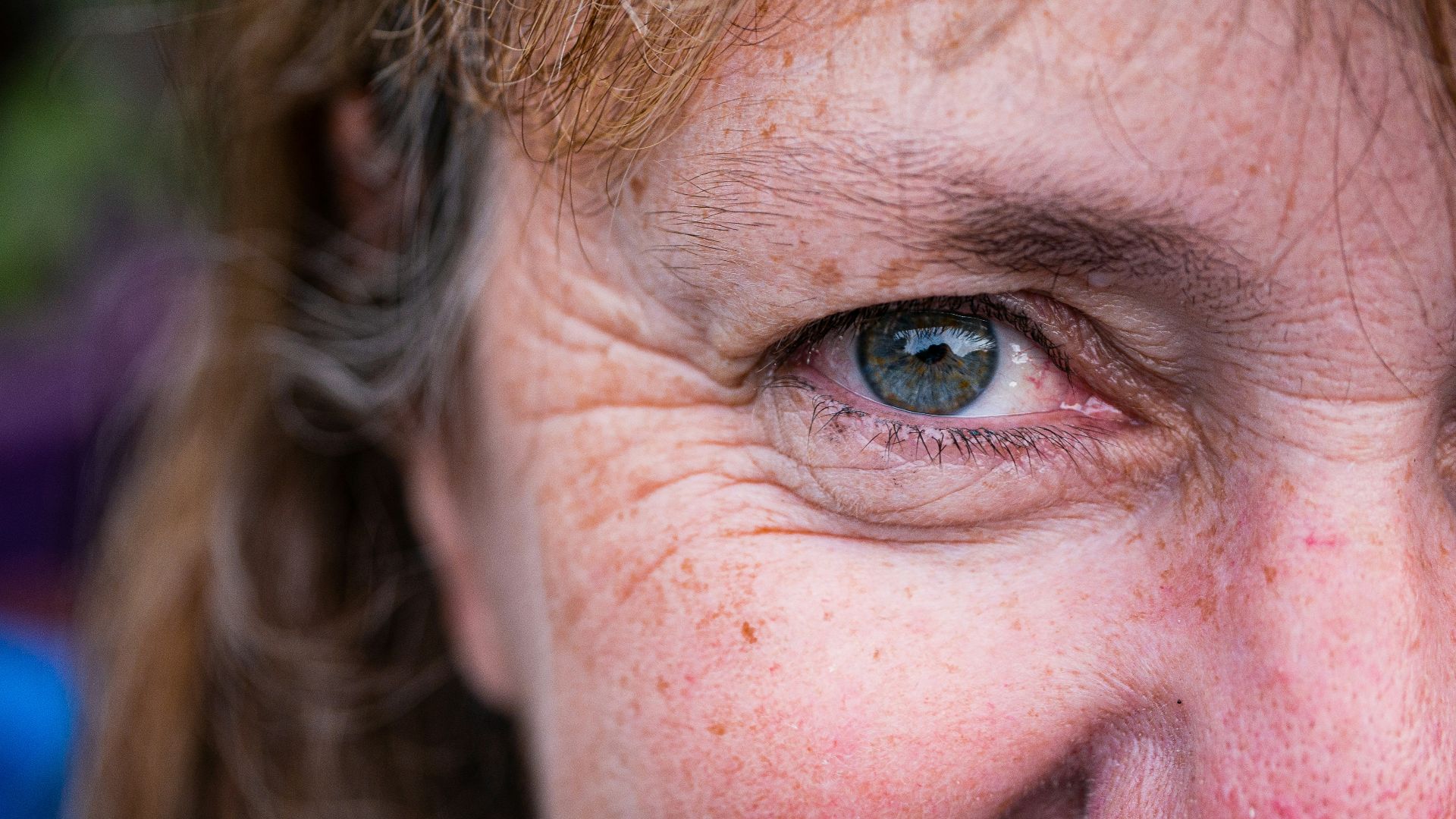 a close up of a person with freckled hair