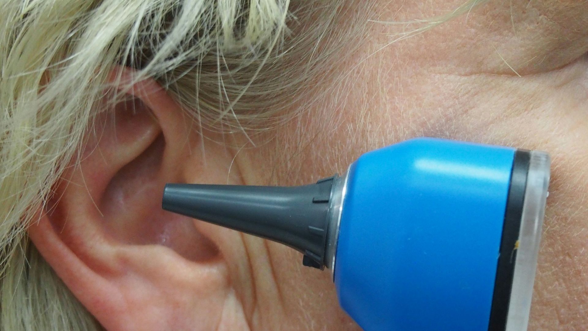A doctor is using an otoscope to check ear.