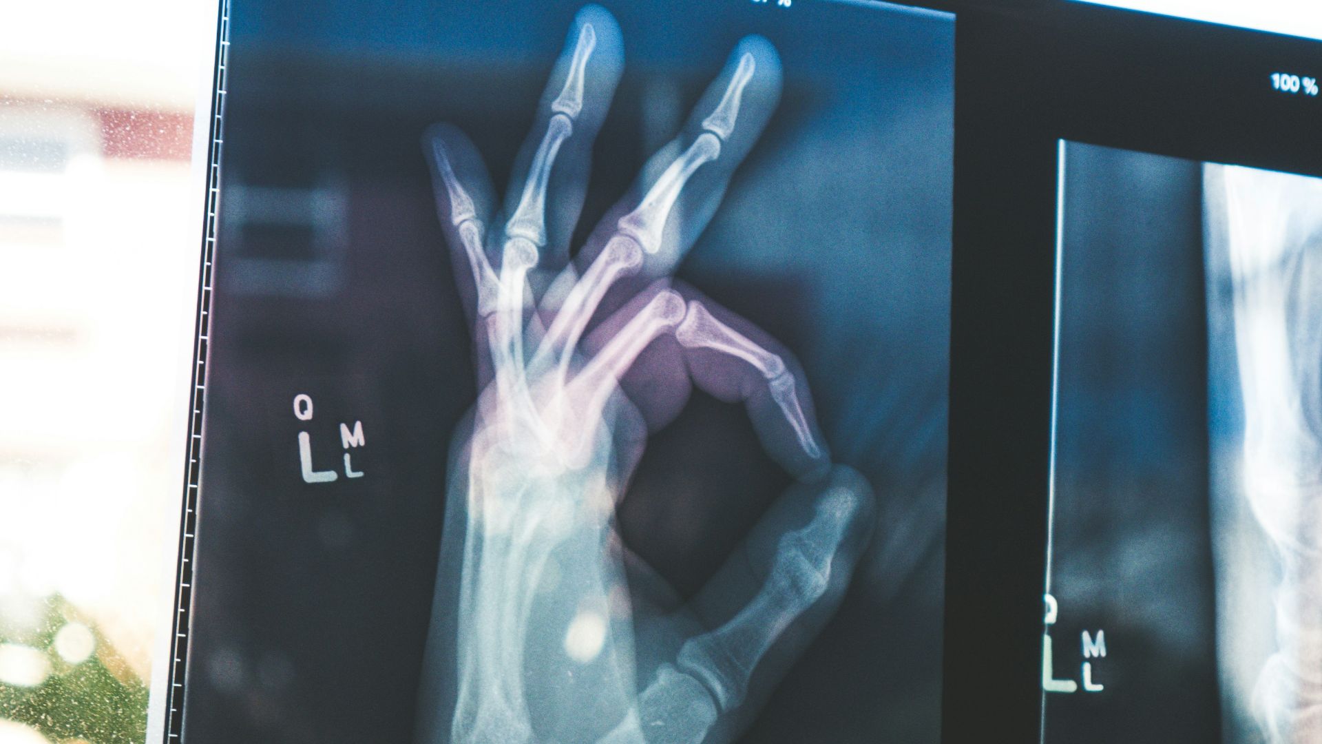 citiscan result hand ok