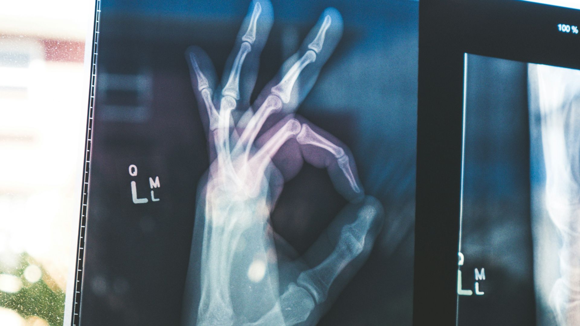 citiscan result hand ok