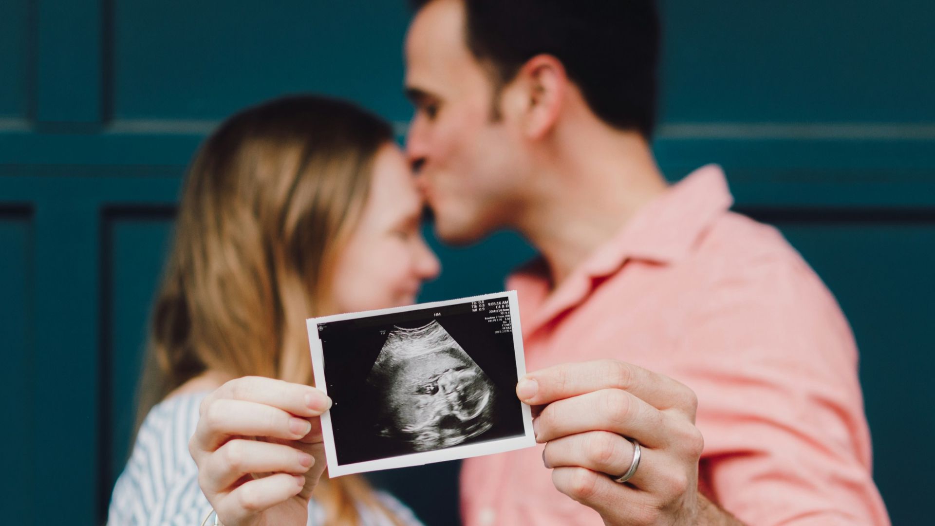 man kissing woman's forehead white holding ultrasound photo
