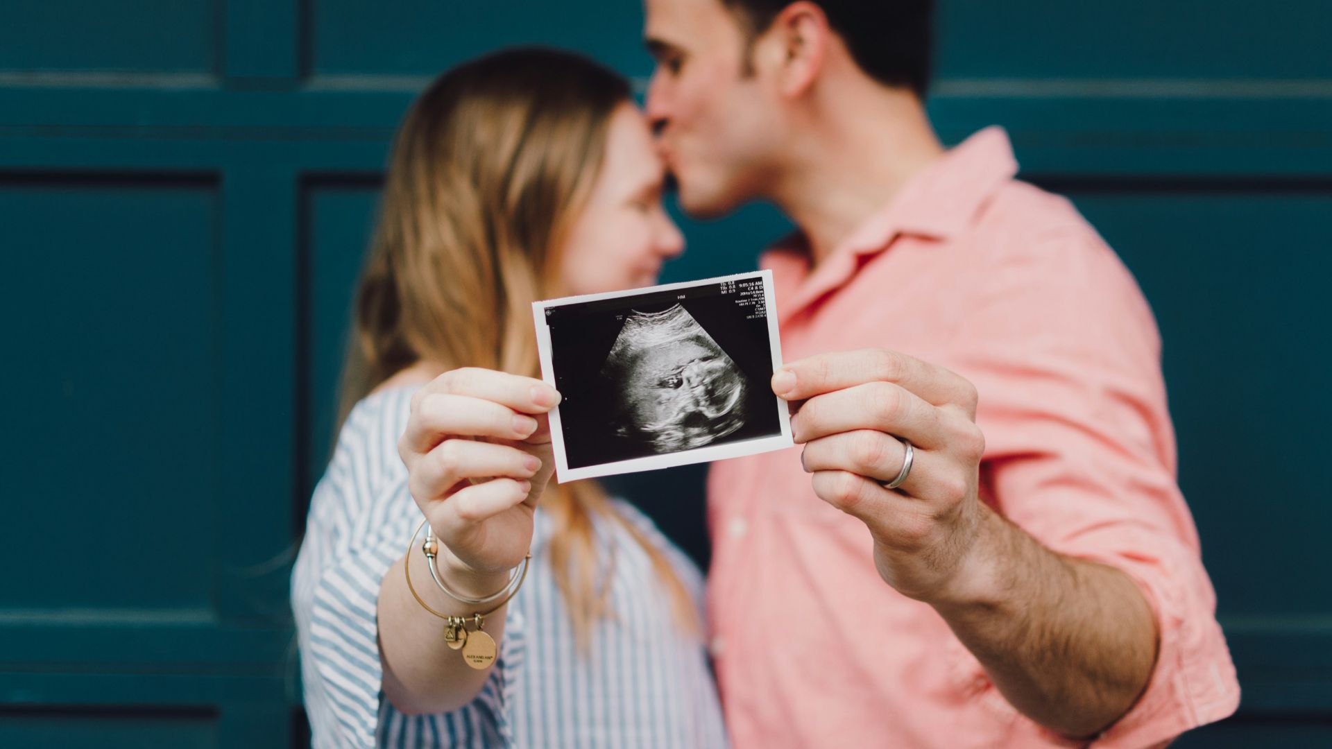 man kissing woman's forehead white holding ultrasound photo