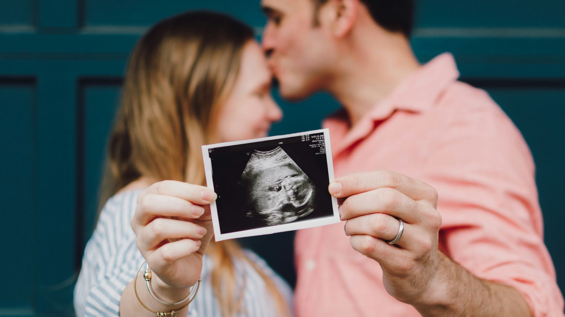 man kissing woman's forehead white holding ultrasound photo