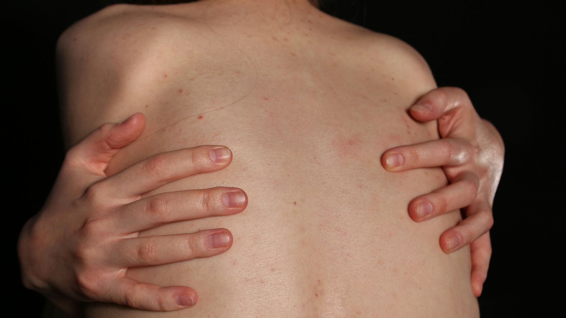 A person embraces their back with both hands.